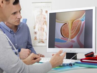 Ένας ουρολόγος συμβουλεύεται έναν ασθενή σχετικά με την προστατίτιδα και τις μεθόδους αντιμετώπισής της.